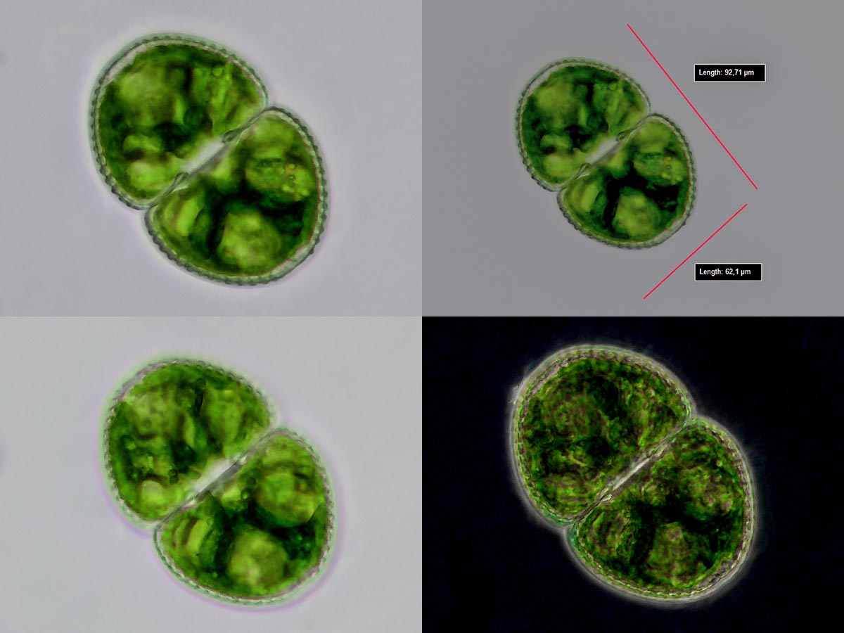 Cosmarium botrytis